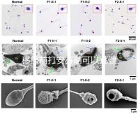 移植前打安蘇萌可以跳健身操嗎？你得到了嗎？