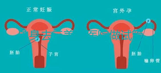 單身去三美泰醫(yī)院做試管需要花費(fèi)多少錢？費(fèi)用明細(xì)是怎么樣的