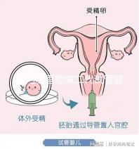 廈門哪里能做二代試管嬰兒，做一次成功率和費用多少？