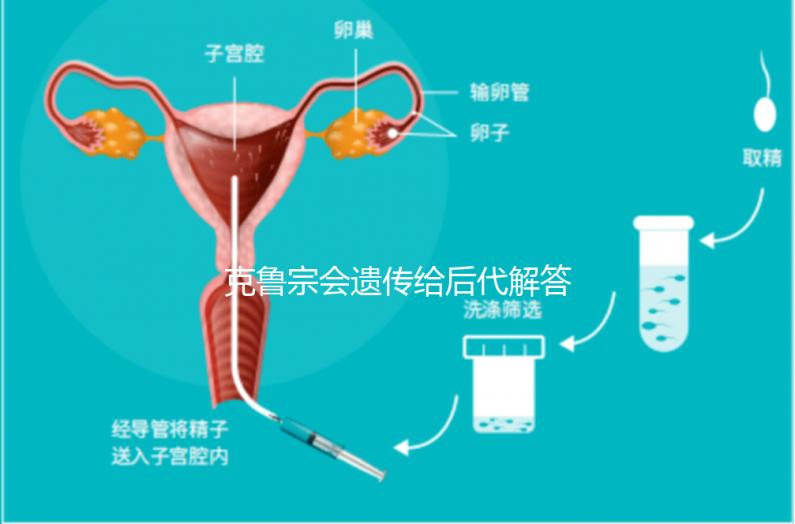 克魯宗會(huì)遺傳給后代解答嗎?他生來就有一篇清晰的文章嗎?