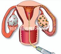別還不造內(nèi)膜10mm鮮胚容不容易著床，能否移植看這幾點(diǎn)