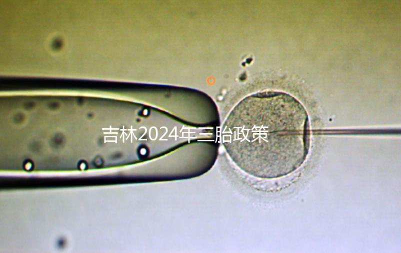 吉林2024年三胎政策最新消息分析,二道、綠園三孩規(guī)定出爐
