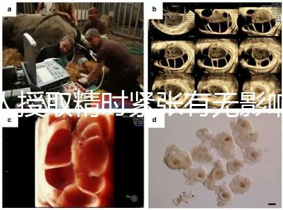 人授取精時緊張有無影響別還不造，注意事項不少不可不知