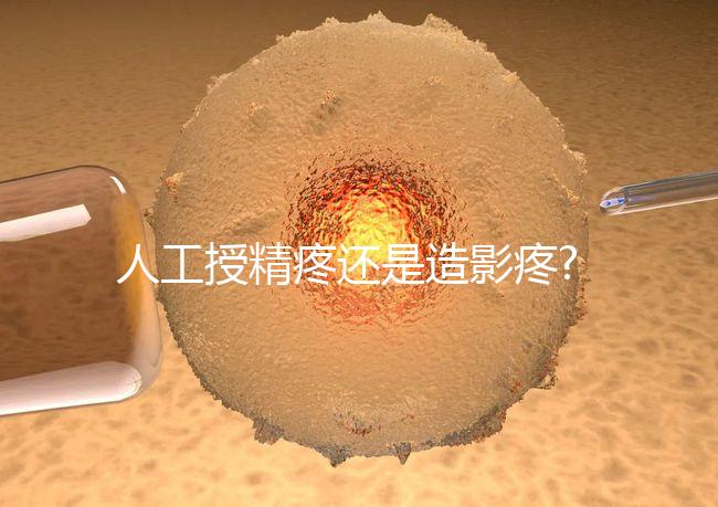 人工授精疼還是造影疼?被瞎對比,二者疼痛不是一個(gè)等級(jí)