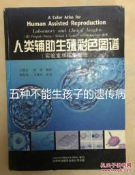 五種不能生孩子的遺傳病大公開,卟啉病能否要寶寶要早知