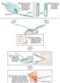 事后24h或72h吃避孕藥有效率真不高,一不小心容易中招