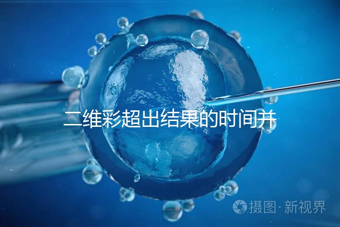 二維彩超出結果的時間并不長，從檢查流程便可看出