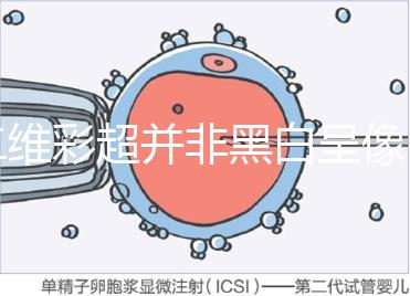 二維彩超并非黑白呈像，通過檢查還能看清胎兒五官