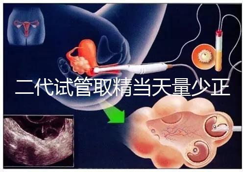 二代試管取精當(dāng)天量少正不正常60s弄清，不造怎么辦速覽