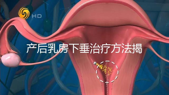 產后乳房下垂治療方法揭秘，按摩手法再好也沒提前預防有用