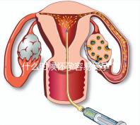 什么時(shí)候懷孕容易受孕？