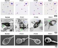 為何試管嬰兒都不順產(為何試管嬰兒都不順產呢)