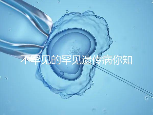 不罕見的罕見遺傳病你知道嗎？帶你認識下特納綜合癥