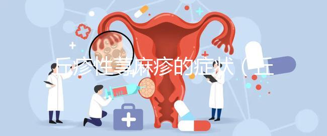 丘疹性蕁麻疹的癥狀（丘疹性蕁麻疹的癥狀表現）