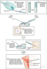 懷孕期間如何降血糖效果更好?