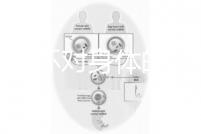 揭秘上環(huán)對(duì)身體的5大壞處，女人別再無(wú)知了
