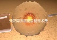 武漢同濟(jì)醫(yī)院采精手術(shù)費(fèi)用分析,顯微采精也可報(bào)銷
