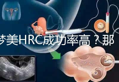 夢美HRC成功率高？那是因為有這些試管嬰兒醫生