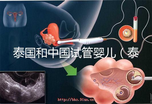 泰國(guó)和中國(guó)試管嬰兒(泰國(guó)和中國(guó)試管嬰兒技術(shù)差距)