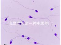 流鼻血與這三種水果的“奇妙”關系，建議少吃，多補充維生素K可以幫助止血！