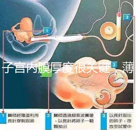 子宮內膜厚度很關鍵，薄了厚了試管嬰兒都難成功