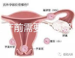 孕婦產前需要注意哪些事項？