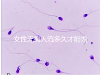 女性無痛人流多久才能恢復健康？