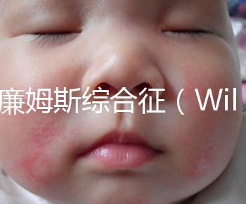 威廉姆斯綜合征(Williams syndrome)是遺傳的嗎?