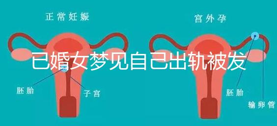 已婚女夢(mèng)見自己出軌被發(fā)現(xiàn)什么意思來瞧,或和心理有關(guān)系