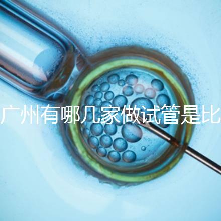 廣州有哪幾家做試管是比較靠譜的，最近有打算？