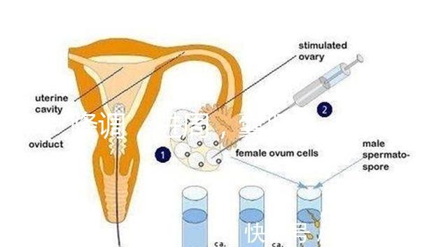 降調(diào),進(jìn)周,囊胚……這些試管嬰兒助孕術(shù)語(yǔ)你都懂嗎?