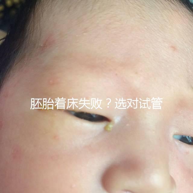 胚胎著床失敗？選對(duì)試管嬰兒醫(yī)生很重要