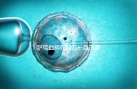 臍帶血捐贈后萬一自己要用怎么要早知，懷孕的趁早了解