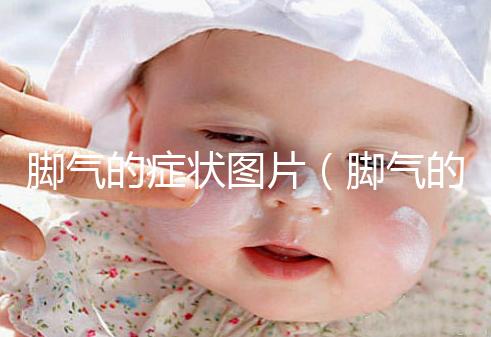 腳氣的癥狀圖片（腳氣的癥狀圖片,腳氣圖片大全）