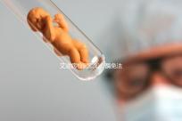 艾滋病檢測須知：酶免法3代與4代排除時(shí)間不同