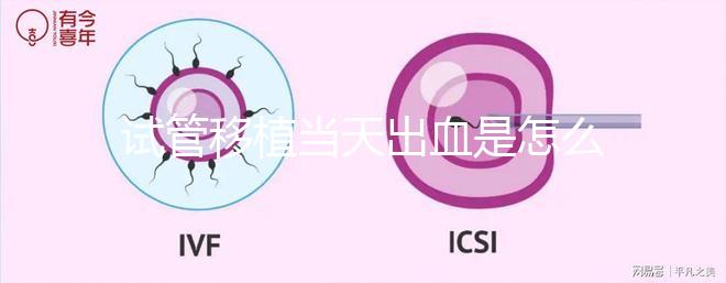 試管移植當(dāng)天出血是怎么回事？收好你的“玻璃心”別太擔(dān)心