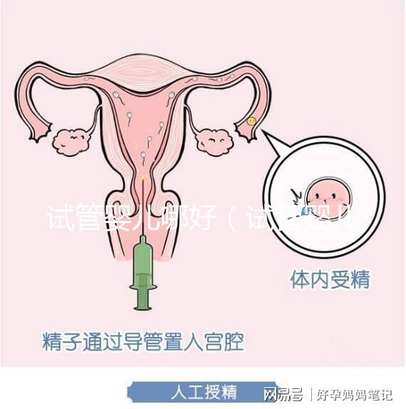 試管嬰兒哪好（試管嬰兒權威醫(yī)院哪家最好）