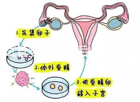 試管嬰兒二超后減藥原因已找到，對胎兒沒影響別瞎擔心