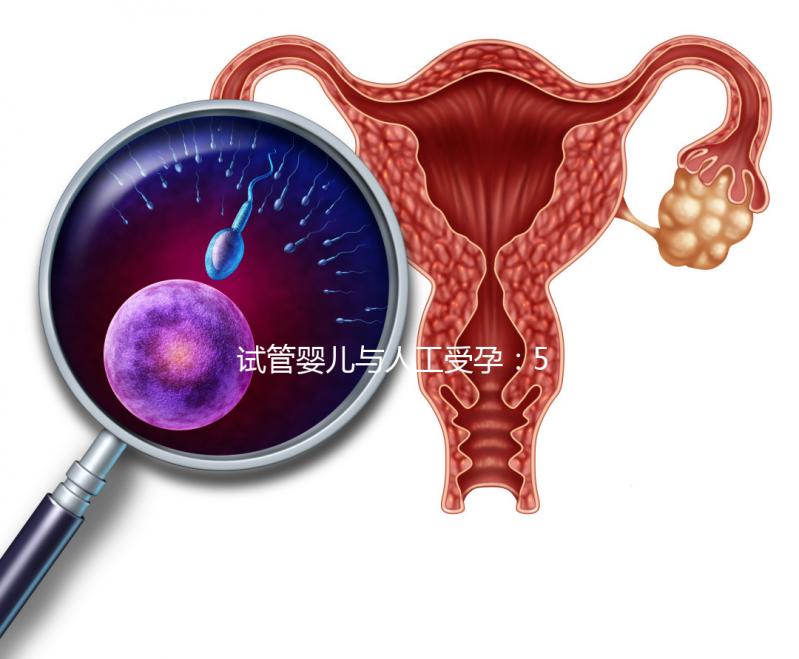 試管嬰兒與人工受孕:5個關鍵區別