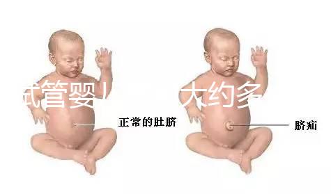 試管嬰兒費(fèi)用大約多少2020年（試管嬰兒費(fèi)用大約多少2020年上海）