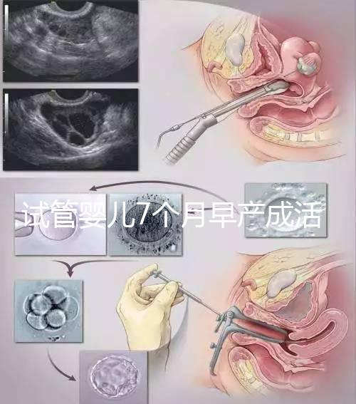 試管嬰兒7個月早產成活率高達80%！能不能要看身體狀況