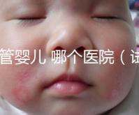 試管嬰兒 哪個醫(yī)院(試管嬰兒哪個醫(yī)院做的最好)