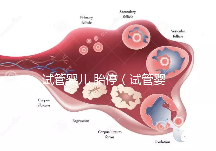 試管嬰兒 胎停（試管嬰兒胎停是什么原因引起的）
