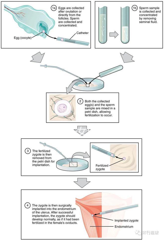 貴陽未婚子女戶口如何向婦女介紹，附2024年結(jié)算流程