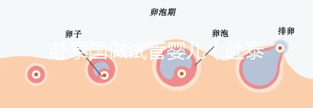 赴泰國(guó)做試管嬰兒（赴泰國(guó)做試管嬰兒要多少錢(qián)）