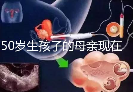 50歲生孩子的母親現在過得真不怎么樣，大齡不建議沖三胎