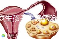 39歲生孩子太晚危險大別不care，進來聽聽生二胎真實感受