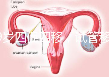 39歲四促四移，試管移植失敗5次后應該怎么辦？