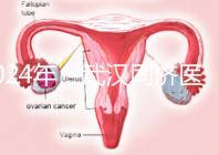 2024年，武漢同濟(jì)醫(yī)院不孕癥醫(yī)生排名公布，選擇專家迅速登記