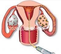 2024武漢免費葉酸外國人可以領取,符合條件就來江漢區